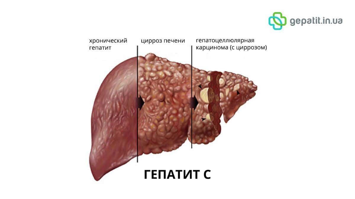 Гепатит у кошек: причины и симптомы, диагностика и терапия, препараты для эффективного лечения и профилактики в домашних условиях агрессивным течением заболевания